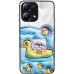 TPU+PC чохол Prisma Fluffie для Xiaomi Poco X6 / Note 13 Pro 5G