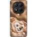 TPU+PC чохол Prisma Fluffie для Xiaomi Redmi Note 14 Pro 5G TPU+PC чохол Prisma Fluffie для Xiaomi Redmi Note 14 Pro 5G