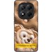 TPU+PC чохол Prisma Fluffie для Xiaomi Redmi Note 14 4G (Int. version)